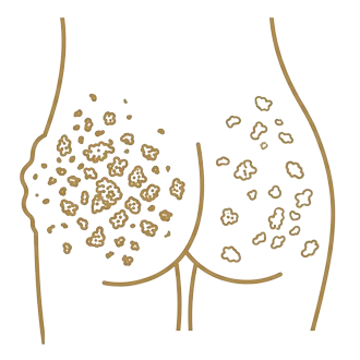 Retiro de Biopolímeros